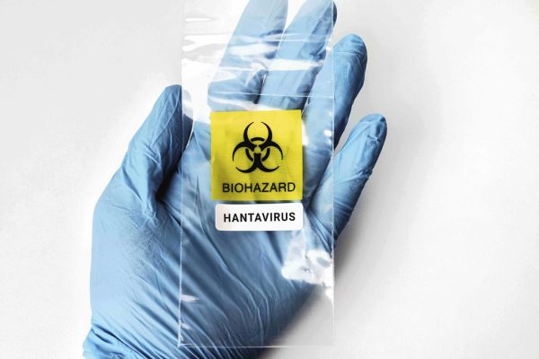 Hantavirus: How the Outbreak Began